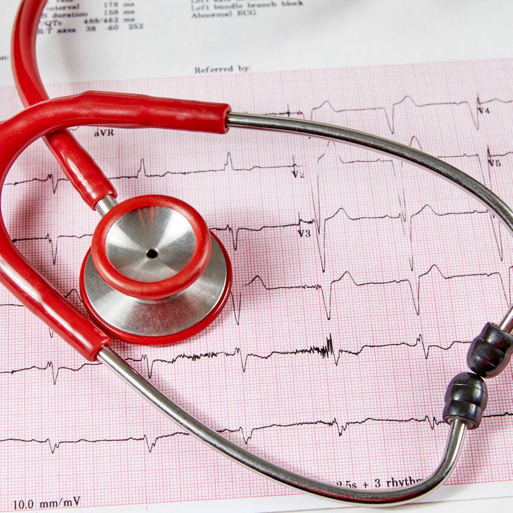 Herzrhythmusstörungen Kardiologie & Gefäßmedizin Universimed Medizin im Fokus