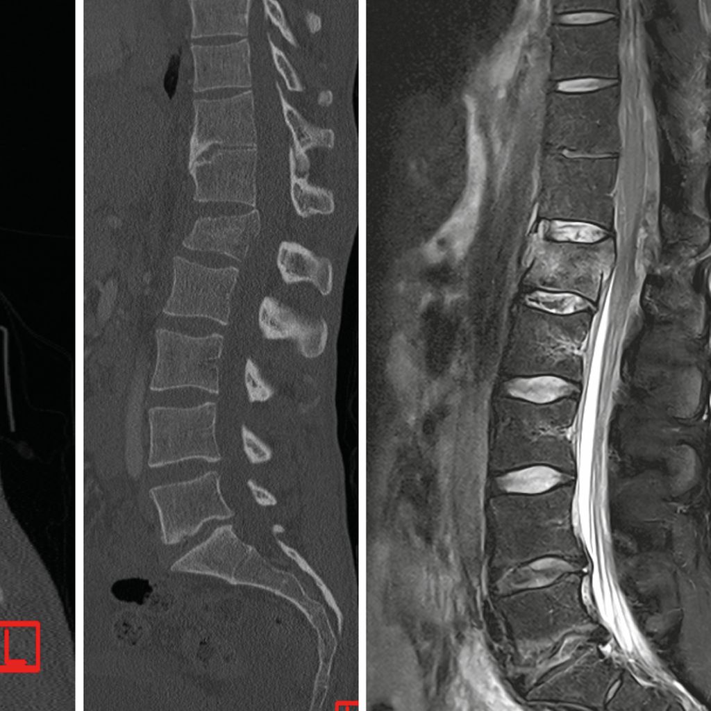 „Missed injuries“ beim polytraumatisierten Patienten - Orthopädie ...